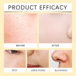 Close-up skin comparison demonstrating pore cleaning and blackhead removal efficacy
