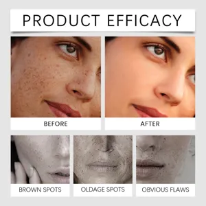 Loción correctora de manchas oscuras para la cara, tratamiento hidratante facial.