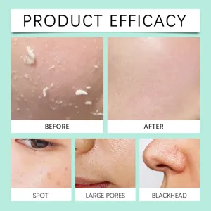 Effective skincare sleeping mask efficacy details showing skin before and after treatment.