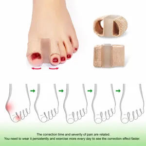 Correttore di alluce valgo per donna e uomo, separatore di dita in silicone per sollievo dal dolore.