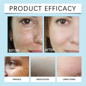 Vista detallada de la mascarilla facial Hoygi con eficacia antiarrugas e hidratación.