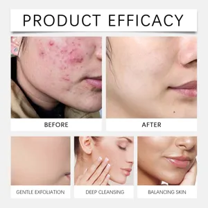 Discos exfoliantes de ácido glicólico eficacia cutánea vista detallada antes y después.