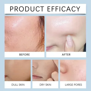Graphique détaillé d'efficacité montrant la peau du visage avant et après la mousse.