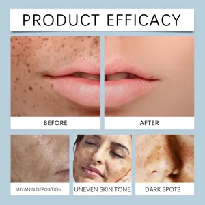 Before and after comparison of facial brightening gel for dark spots and melanin deposition.