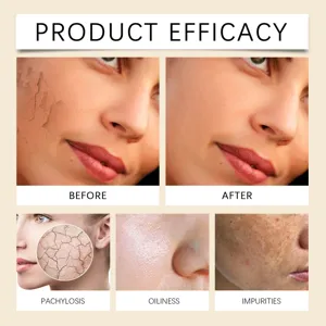 Mascarilla de lodo limpiador facial de cúrcuma para poros profundos e hidratación