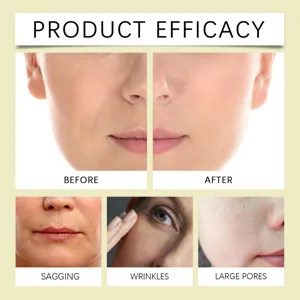 Μασκα προσωπου Niacinamide Vitamin C εικονιδιο λεπτομερειας αποτελεσματικου δερματος μας.