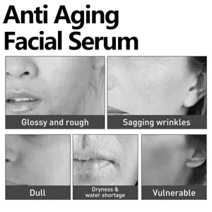 Siero viso anti-invecchiamento mostra problemi cutanei come rughe, secchezza e opacità.
