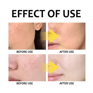 Skincare effect detail view showing skin texture improvement before and after use clearly.