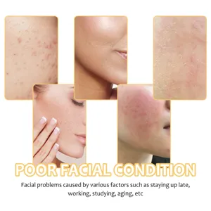 Facial skin condition cleaning pad detail image showing acne and pore problems clearly.