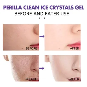 Gros plan de détail montrant le nettoyage des pores et l'effet éclaircissant du gel perilla.