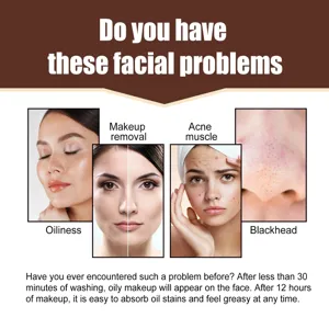 Detailinfografiek over gezichtshuidproblemen met overtollig vet, acne en mee-eters.