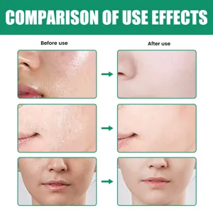 Nettoyant visage comparatif avant et après montrant un nettoyage des pores en profondeur.