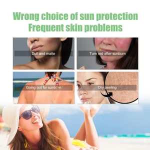 Détail crème solaire avec problèmes de coups de soleil, soin UV, soin rafraîchissant.