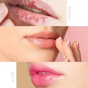 Lip mask detail showing before and after effect, moisturizing and smooth lip care close-up.