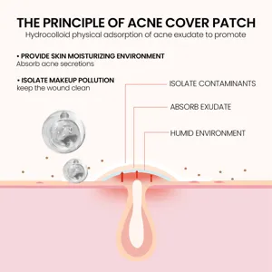 Hydrokolloid Akne Patch Funktionsweise Detaildiagramm zeigt Absorption und Schutz.
