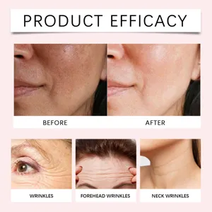 Detailed view showing anti-aging facial and neck wrinkle reduction results before and after.