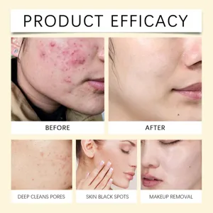 HOYGI turmeric kojic acid cleansing pads detail image showing deep pore cleansing and efficacy.
