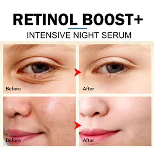 Siero Notte Intensivo Retinol Boost, vista dettagliata che mostra la riduzione di rughe e pori.