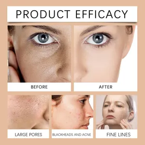 Vue détaillée montrant l'efficacité du masque peel-off au collagène OUHOE pour la peau.