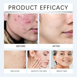 Nettoyant pour le visage aux acides aminés nettoyage en douceur hydratant éclat de la peau
