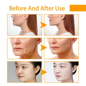 Crème de soin facial effet avant après montrant anti-âge, fermeté et peau lumineuse et douce.
