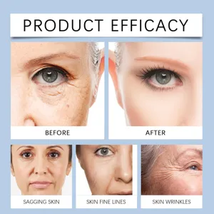 Facial lifting bandage efficacy chart showing before and after results on skin fine lines.