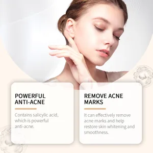 Detailed view of salicylic acid anti-acne face cream smoothing and clearing skin blemishes.