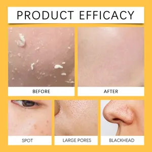 Mascarilla exfoliante de cúrcuma detalle que muestra eficacia, poros y puntos negros.