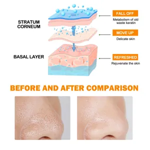 Detailed infographic showing skin layers and pore cleansing before and after comparison effect.