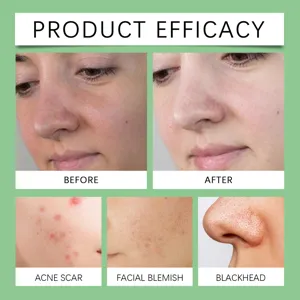Groene tomaat reinigende moddermasker voor gezichtsporen, mee-eters en acne-litteken details.