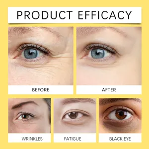 Sérum Yeux Fermeté OUHOE Anti-Rides Hydratant Soin Contour des Yeux pour les Cernes Sombres