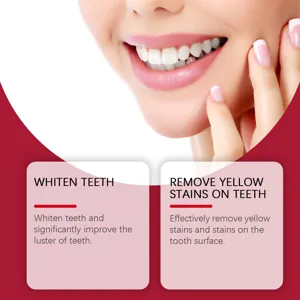 Gros plan sur des dents blanches éclatantes, montrant le blanchiment et les taches.