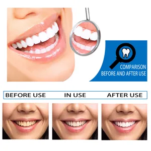 Essence de blanchiment des dents avant et apres comparaison montre sourires eclatants.