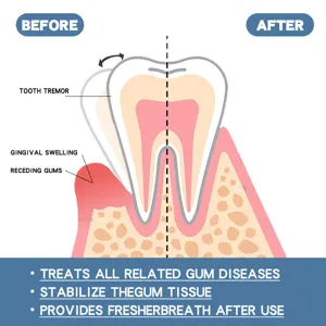 Gedetailleerd diagram toont tandvleesproblemen en tandgezondheid voor en na de behandeling.