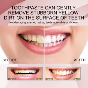 Teeth whitening toothpaste detail view showing effective yellow stain removal and bright clean teeth results.