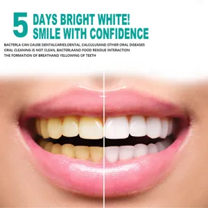 Gros plan détaillé de l'effet de blanchiment des dents, montrant un sourire éclatant.