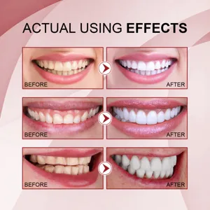 Teeth whitening toothpaste detail showing before and after results for effective stain removal care.