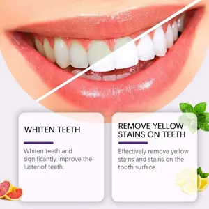 Teeth whitening detail view showing clean bright smile and yellow stain removal results clearly.
