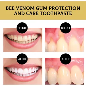 Dentifrice protection gencives au venin d'abeille image détaillée avec résultats de blanchiment.