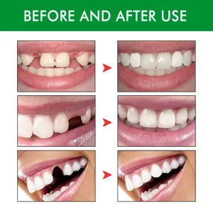Kit de facettes dentaires temporaires pour combler les dents et réparer l'avant et l'après.