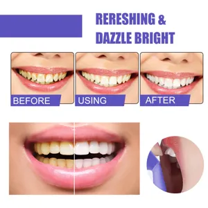 Comparaison d'effet de blanchiment des dents et détails d'utilisation pour sourire.