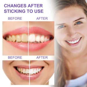 Détail de comparaison avant et après blanchiment des dents avec un sourire éclatant.