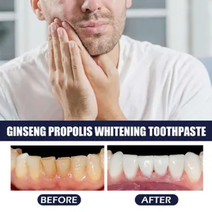 Ginseng Propolis Zahncreme zur Zahnaufhellung und effektiven Entfernung von Zahnbelag.