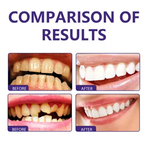 Teeth whitening toothpaste result comparison chart showing before and after bright white smile.