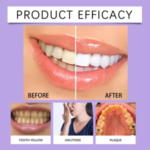 Penna sbiancante efficacia infografica prima e dopo risultati dettagli cura dentale.