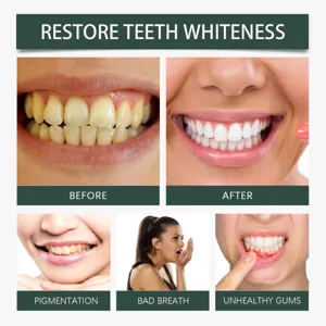 Agent de soins bucco-dentaires blanchiment des dents WOODSLEEP pour une haleine fraîche.