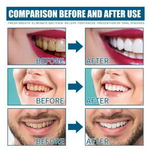 Mouthwash teeth stain removal oral care fresh breath oral hygiene daily teeth whitening liquid