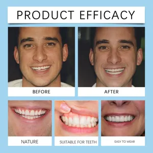 Facette dentaire cosmétique clip sur fausses dents sourire instantané confort ajusté