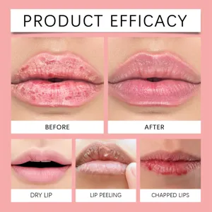 Watermelon lip mask for moisturizing and nourishing, dry lip care and repair treatment.