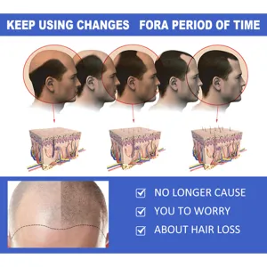 Ingwer Haarspray Detailbild zeigt den Kopfhautmechanismus und Haarpflegeergebnis.